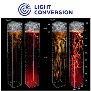 Nonlinear Microscopy